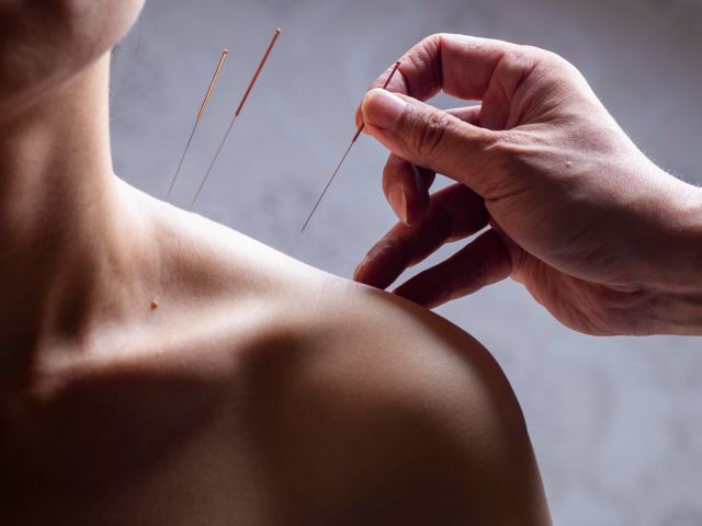Akupunktur Ağrıyı Azaltabilir Mi